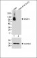 Stat3 Antibody [Knockout Validated]